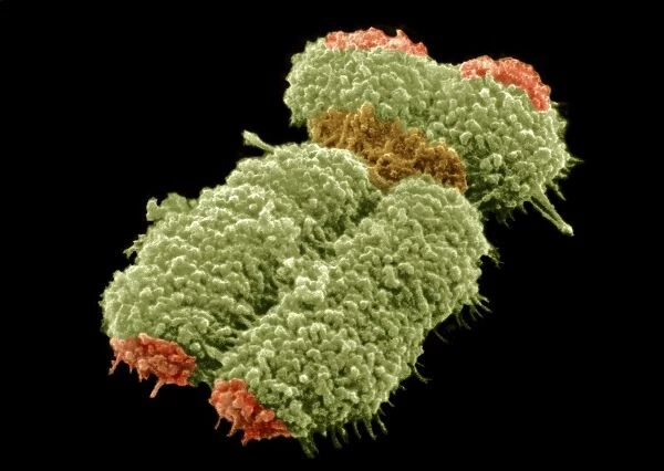 Human chromosome, SEM C013  /  4998
