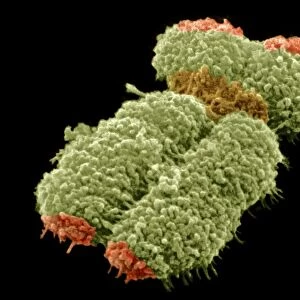 Human chromosome, SEM C013 / 4998