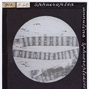 Sphaeroplea annulina, belonging to the Sphaeropleacea family, enlarged under a microscope